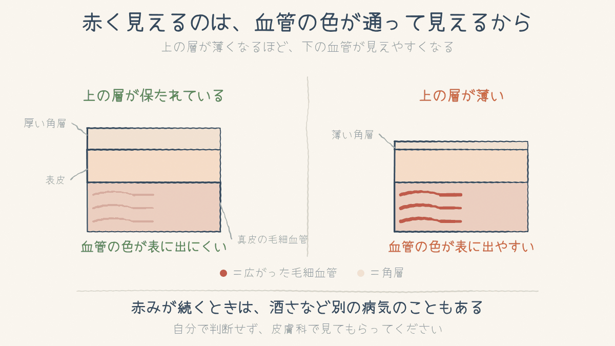 上の層が厚いときと薄いときで、真皮の毛細血管の色の見えやすさを比べた断面図